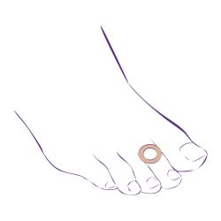 Протектор-кольцо от мозолей СТ-63  Trives