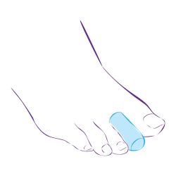 СТ-44 (L) Приспособление корригирующие (колпачок защитный)