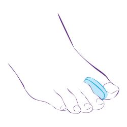 СТ-32 Межпальцевый вкладыш