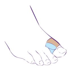 Перегородка межпальцевая с петлей на первый палец стопы на тканевой основе СТ-54.4  Trives