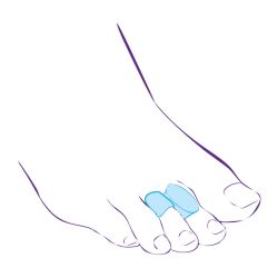 Перегородка межпальцевая СТ-54.6  Trives